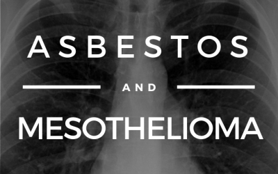 Asbestos & Mesothelioma: Know Your Rights